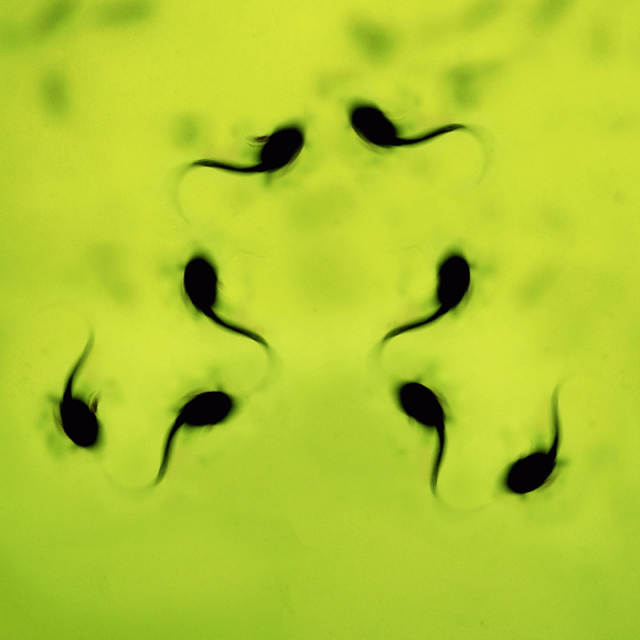 tadpoles